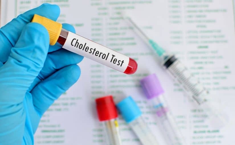 Cholesterin getestet im Blut